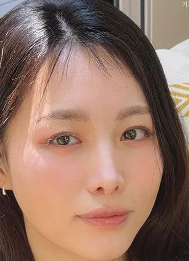 이지혜